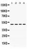Damage Specific DNA Binding Protein 2 antibody, PB9757, Boster Biological Technology, Western Blot image 