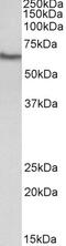 Creatine Kinase, M-Type antibody, 43-272, ProSci, Enzyme Linked Immunosorbent Assay image 