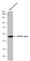 Phosphatidylinositol-5-Phosphate 4-Kinase Type 2 Alpha antibody, GTX118243, GeneTex, Western Blot image 