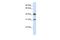 Decaprenyl Diphosphate Synthase Subunit 2 antibody, PA5-43235, Invitrogen Antibodies, Western Blot image 