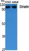 Striatin antibody, A05855, Boster Biological Technology, Western Blot image 