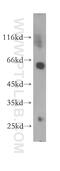 Coronin 1A antibody, 17760-1-AP, Proteintech Group, Western Blot image 