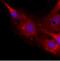 Neurocan antibody, orb76731, Biorbyt, Immunohistochemistry paraffin image 