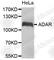 Adenosine Deaminase RNA Specific antibody, A5914, ABclonal Technology, Western Blot image 