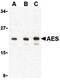 TLE Family Member 5, Transcriptional Modulator antibody, PA5-20169, Invitrogen Antibodies, Western Blot image 