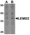 LEM Domain Containing 2 antibody, A09079, Boster Biological Technology, Western Blot image 