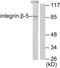 Integrin Subunit Beta 5 antibody, LS-C118490, Lifespan Biosciences, Western Blot image 