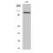 Integrin Subunit Beta 3 antibody, LS-C384161, Lifespan Biosciences, Western Blot image 
