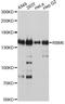 RNA Binding Motif Protein 6 antibody, A10391, ABclonal Technology, Western Blot image 