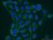 Slingshot Protein Phosphatase 3 antibody, 18324-1-AP, Proteintech Group, Immunofluorescence image 