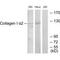 Collagen Type I Alpha 2 Chain antibody, PA5-49912, Invitrogen Antibodies, Western Blot image 