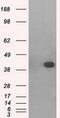 Mitogen-Activated Protein Kinase 11 antibody, GTX84149, GeneTex, Western Blot image 