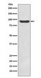 Inhibitor Of Nuclear Factor Kappa B Kinase Subunit Beta antibody, M00118, Boster Biological Technology, Western Blot image 