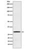 Caudal Type Homeobox 1 antibody, M04522-1, Boster Biological Technology, Western Blot image 