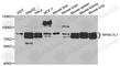 Nuclear Receptor Binding SET Domain Protein 3 antibody, A5577, ABclonal Technology, Western Blot image 