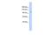 ST18 C2H2C-Type Zinc Finger Transcription Factor antibody, PA5-40764, Invitrogen Antibodies, Western Blot image 