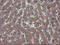 RING1 And YY1 Binding Protein antibody, M04316, Boster Biological Technology, Immunohistochemistry paraffin image 