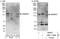 Sterol Regulatory Element Binding Transcription Factor 2 antibody, NBP1-71880, Novus Biologicals, Immunoprecipitation image 