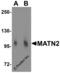 Matrilin 2 antibody, 5105, ProSci Inc, Western Blot image 