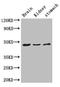 Acylglycerol Kinase antibody, LS-C501029, Lifespan Biosciences, Western Blot image 