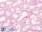 Somatostatin Receptor 2 antibody, LS-A998, Lifespan Biosciences, Immunohistochemistry paraffin image 