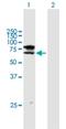 ST6 N-Acetylgalactosaminide Alpha-2,6-Sialyltransferase 1 antibody, H00055808-B01P, Novus Biologicals, Western Blot image 