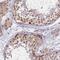 Treacher Collins syndrome protein antibody, NBP1-86909, Novus Biologicals, Immunohistochemistry paraffin image 