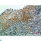 Interferon Regulatory Factor 3 antibody, LS-C813897, Lifespan Biosciences, Immunohistochemistry paraffin image 