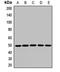 Adaptor Related Protein Complex 1 Subunit Mu 1 antibody, LS-C668288, Lifespan Biosciences, Western Blot image 