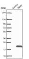 Retinol Binding Protein 2 antibody, NBP1-85464, Novus Biologicals, Western Blot image 