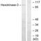 Hexokinase 3 antibody, A05145, Boster Biological Technology, Western Blot image 
