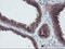 Archain 1 antibody, LS-C173756, Lifespan Biosciences, Immunohistochemistry paraffin image 