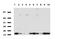 NME/NM23 Nucleoside Diphosphate Kinase 1 antibody, LS-C796840, Lifespan Biosciences, Western Blot image 