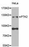 Protein Tyrosine Kinase 2 antibody, STJ25213, St John