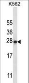 Interleukin 22 antibody, LS-C165197, Lifespan Biosciences, Western Blot image 