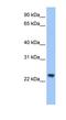 Tripartite Motif Containing 48 antibody, NBP1-79458, Novus Biologicals, Western Blot image 