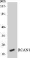 Regulator Of Calcineurin 1 antibody, LS-B11434, Lifespan Biosciences, Western Blot image 