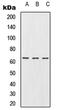 URI1 Prefoldin Like Chaperone antibody, MBS821921, MyBioSource, Western Blot image 