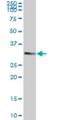 Tafazzin antibody, H00006901-M13, Novus Biologicals, Immunocytochemistry image 