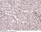 CUE Domain Containing 2 antibody, 11466-R003, Sino Biological, Immunohistochemistry paraffin image 