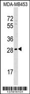 Axin Interactor, Dorsalization Associated antibody, 59-338, ProSci, Western Blot image 