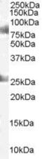 Chromodomain Y Like antibody, PA5-18123, Invitrogen Antibodies, Western Blot image 