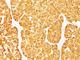 Melan-A antibody, V3156IHC-7ML, NSJ Bioreagents, Immunohistochemistry paraffin image 