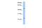 Transmembrane And Coiled-Coil Domains 1 antibody, PA5-43350, Invitrogen Antibodies, Western Blot image 