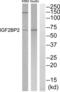 Insulin Like Growth Factor 2 MRNA Binding Protein 2 antibody, abx015090, Abbexa, Western Blot image 