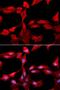 Glutamate-Cysteine Ligase Modifier Subunit antibody, LS-C333974, Lifespan Biosciences, Immunofluorescence image 