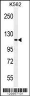 SKI Family Transcriptional Corepressor 2 antibody, 56-165, ProSci, Western Blot image 