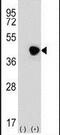 DNA Fragmentation Factor Subunit Alpha antibody, PA5-26294, Invitrogen Antibodies, Western Blot image 