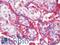 Triggering Receptor Expressed On Myeloid Cells 1 antibody, LS-B10694, Lifespan Biosciences, Immunohistochemistry paraffin image 