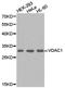 Voltage Dependent Anion Channel 1 antibody, TA326858, Origene, Western Blot image 